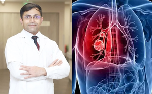 दिल्ली में तेजी से बढ़ रहे हैं निमोनिया के मरीज 