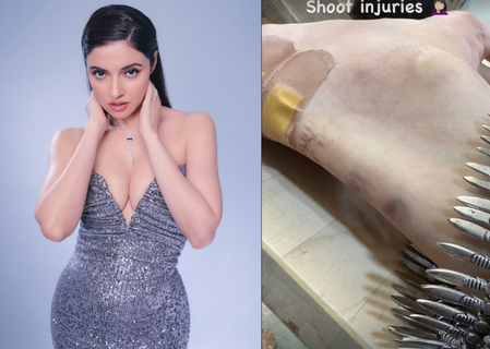 Divya Khossla sustains injury on set while filming her upcoming film