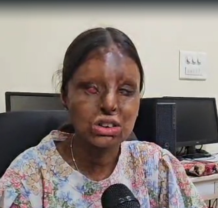 Chandigarh acid attack survivor scores 95.6 per cent in CBSE Class 12, turns tragedy into triumph