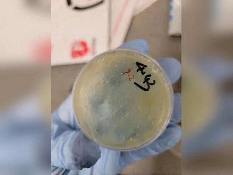 Another Chinese national arrested for smuggling 'roundworms' into US University of Michigan