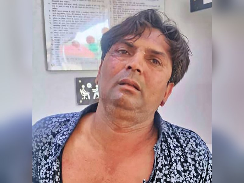 Delhi CM attack case deepens; police arrest Rajesh’s associate Tahseen in alleged murder plot