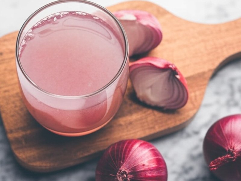 बालों को पोषण देगा प्याज का रस, झड़ने समेत अनेक समस्याओं से मिलेगी राहत