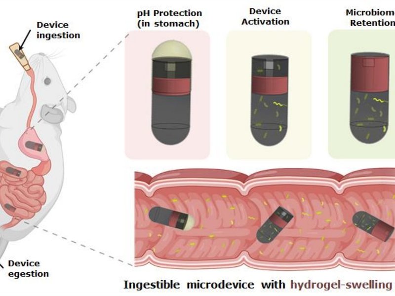 IIT Delhi, AIIMS’s new ingestible device can collect microbial samples from small intestine