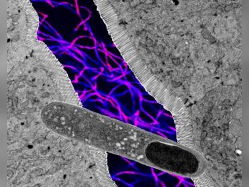 US researchers find gut bacteria that can help lose weight, boost metabolic health