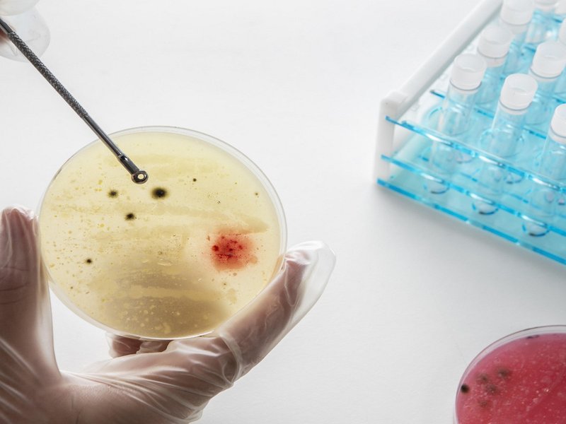 New indigenous antibody discovery platform to transform diagnostics in India