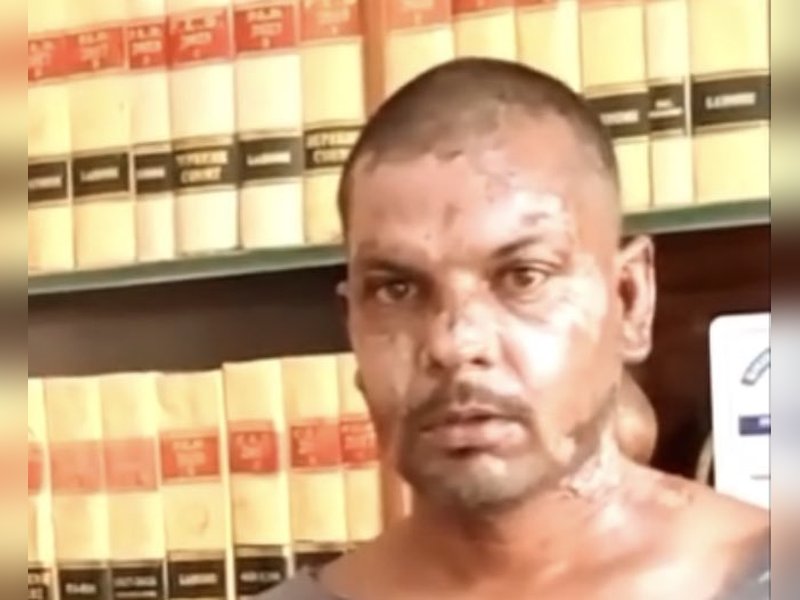 Rights group condemns brutal attack on Christian man in Pakistan