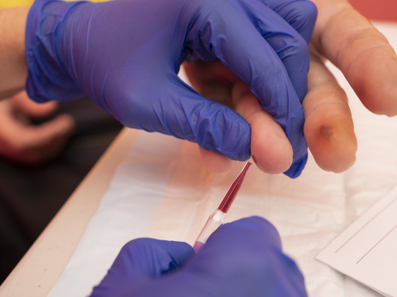 World-first fingerstick test to expand hepatitis B diagnosis access