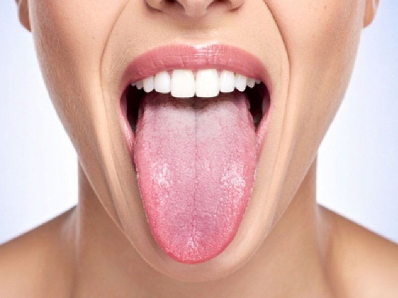 त्रिदोष के असंतुलन का संकेत देती है जीभ, रंग से पहचाने शरीर के विकार