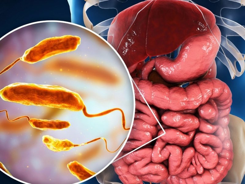 क्यों फिट बॉडी के लिए जरूरी है 'हिट' माइक्रोबायोम?