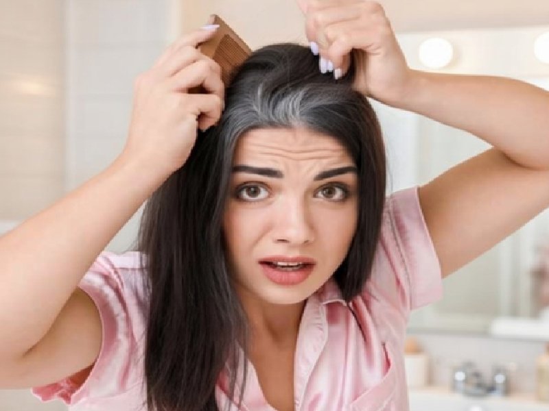 पित्त दोष के असंतुलन से होती है सफेद बालों की परेशानी, जानें कारण से लेकर उपाय