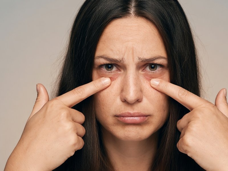 लगातार आंखों की सूजन को नजरअंदाज करना जोखिम भरा, हो सकता है किडनी से जुड़ी बीमारी का शुरुआती संकेत