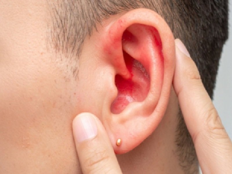 अदरक और सेंधा नमक से बना तेल कानों के दर्द से आराम दिलाने में है प्रभावी, जान लें प्रयोग से पहले की सावधानी