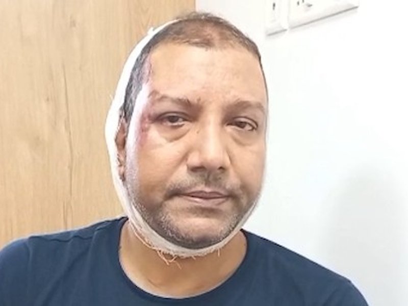 मुझे घेरा गया और हमला किया, उनके पास लाठियां और पत्थर थे: इंस्पेक्टर नंद किशोर सिंह