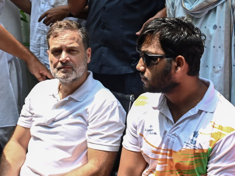 Pellet-gun victim Sahil Lochav says vision still unclear after surgery, alleges FIR not registered