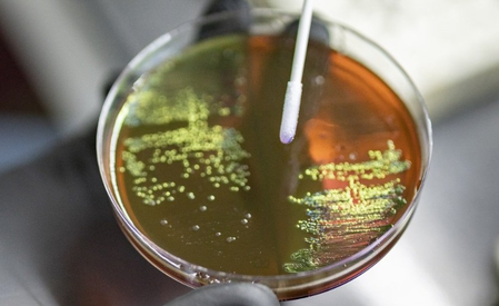 सुपरबग का खतरा! अब दवाईयां भी बेअसर, भारत बना दुनिया का सबसे बड़ा 'हॉटस्पॉट', जानिए वजह