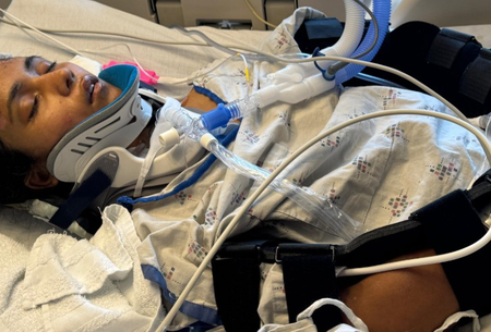 US: Indian girl in coma after crash; community mobilises to help US: Indian girl in coma after crash; community mobilises to help