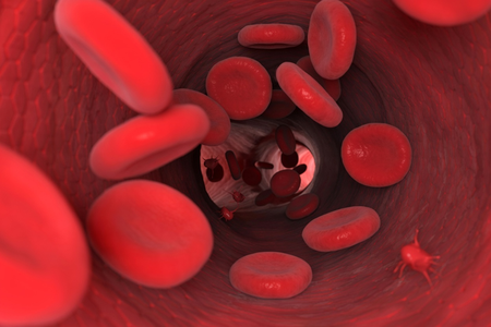 गर्भावस्था में हीमोग्लोबिन की कमी मां और बच्चे दोनों के लिए खतरनाक, इन उपायों से रहें सुरक्षित गर्भावस्था में हीमोग्लोबिन की कमी मां और बच्चे दोनों के लिए खतरनाक, इन उपायों से रहें सुरक्षित