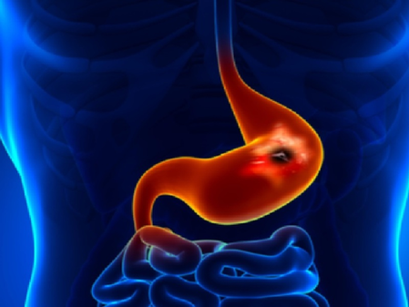 पेट-दर्द सिर्फ पाचन समस्या नहीं, पेट की आंतरिक बीमारियों का भी इशारा है, आयुर्वेद से जानें उपाय