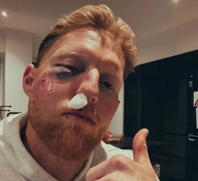 'Cricket balls do serious damage': Stokes vows to 'always wear helmet' after facial injury 'Cricket balls do serious damage': Stokes vows to 'always wear helmet' after facial injury