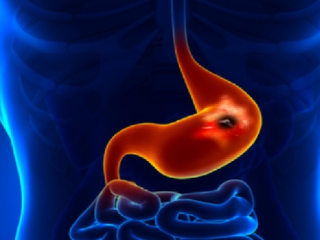 लाइफ कंट्रोल सेंटर है पैंक्रियास, अनदेखा करना होगा सेहत के साथ खिलवाड़