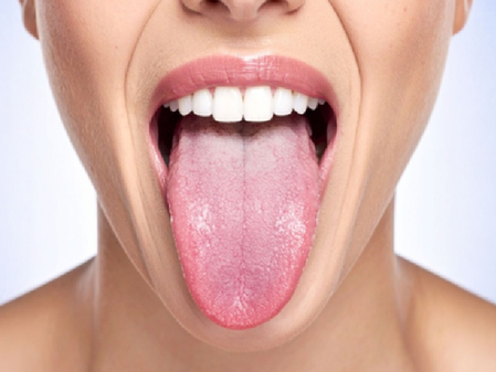 त्रिदोष के असंतुलन का संकेत देती है जीभ, रंग से पहचाने शरीर के विकार