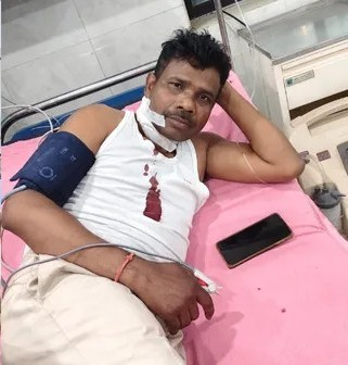 झारखंड अवैध शराब के धंधे के खिलाफ छापेमारी करने गई टीम पर हमला, एक अधिकारी घायल