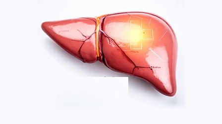 World Liver Day 2026: लिवर के लिए जहर समान है चीनी, फास्ट फूड और तेल का ज्यादा सेवन, इन बातों का रखें खास ध्यान