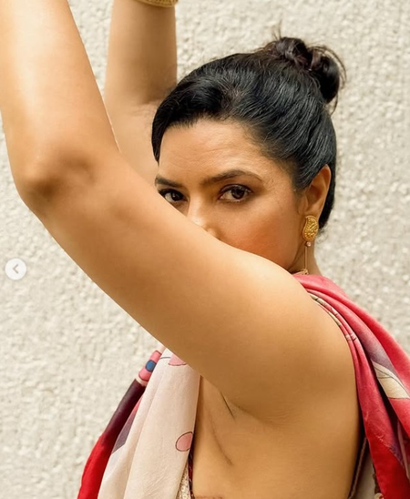 मेरे जख्म मेरी कहानी बयां करते हैं... राजश्री देशपांडे ने शेयर कीं मार्मिक तस्वीरें