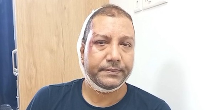 मुझे घेरा गया और हमला किया, उनके पास लाठियां और पत्थर थे  इंस्पेक्टर नंद किशोर सिंह