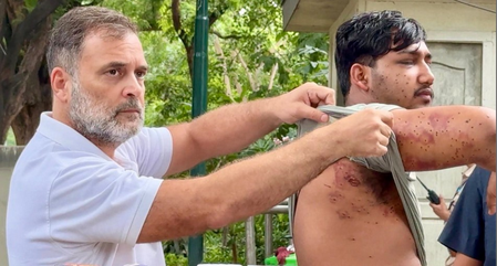 राहुल गांधी ने घायल छात्र को पेशकर लगाया आरोप, छात्रों पर पेलेट गन चलाकर सच छिपा रही सरकार राहुल गांधी ने घायल छात्र को पेशकर लगाया आरोप, छात्रों पर पेलेट गन चलाकर सच छिपा रही सरकार