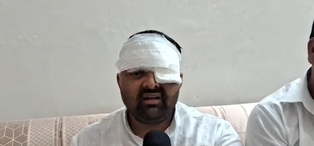 दिग्विजय भाटी ने कहा-मेरठ एसएसपी और सिविल लाइन इंस्पेक्टर ने किया थर्ड-डिग्री टॉर्चर, एक आंख फोड़ने का आरोप दिग्विजय भाटी ने कहा-मेरठ एसएसपी और सिविल लाइन इंस्पेक्टर ने किया थर्ड-डिग्री टॉर्चर, एक आंख फोड़ने का आरोप